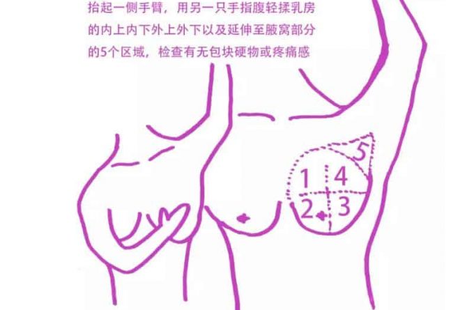 体检查出乳腺结节，会是乳腺癌吗？